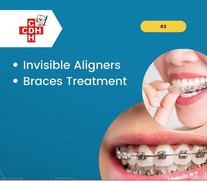 Slider image (5) City Dental - Implant Hospital